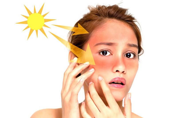 Bức xạ mặt trời gây ảnh hưởng đến da và mắt